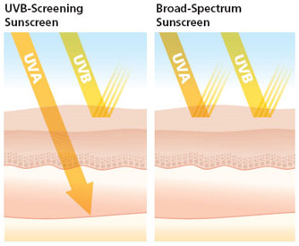 uvb vs  broad spectrum